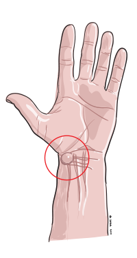 Ganglion